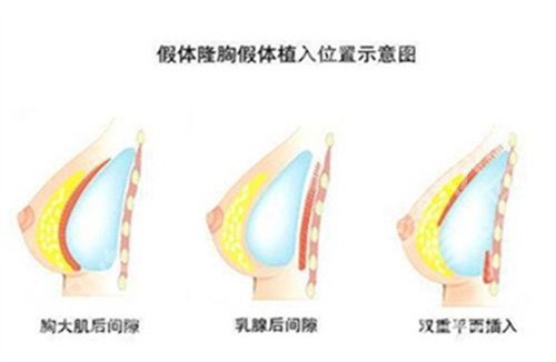 杭州黄剑媚怎么样？医生口碑点评