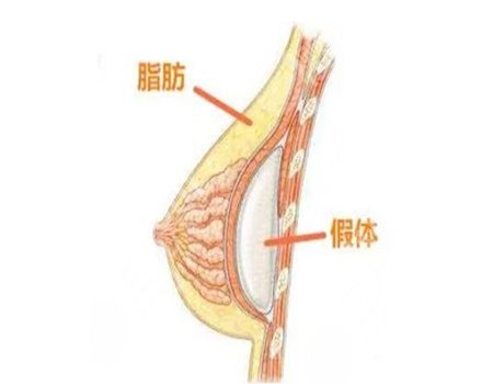 北京艺星假体隆胸怎么样？特色项目参考，真人案例品评