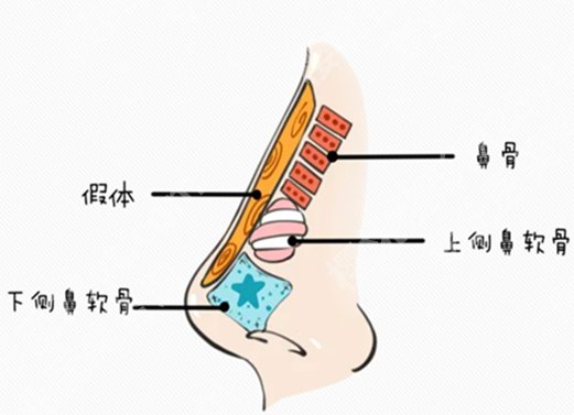 昆明医科大学第一附属医院做鼻子手术费用多少？含隆鼻价格为7800元