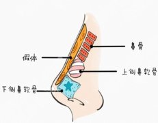 长春张连波鼻子案例怎么样？公布人气案例过程详情