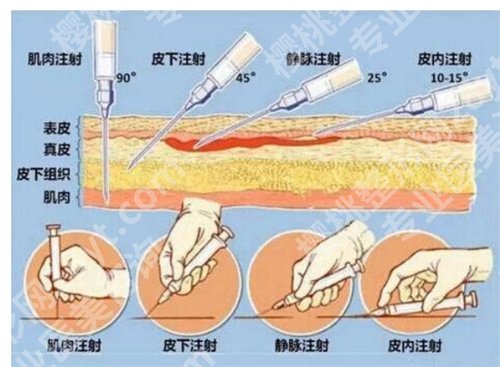 北京丽星翼美医疗美容诊所除皱怎么样？近期案例反馈来袭