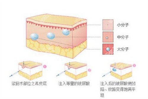 北京丽星翼美医疗美容诊所除皱怎么样？近期案例反馈来袭