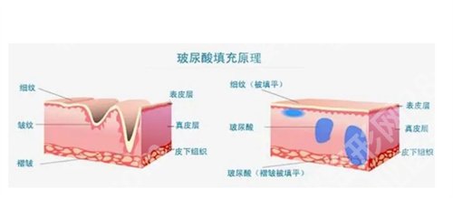 北京丽星翼美医疗美容诊所除皱怎么样？近期案例反馈来袭