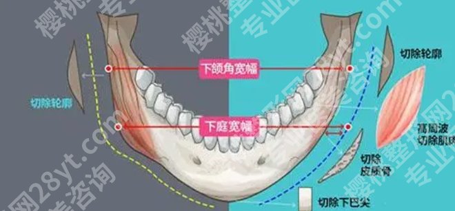 温州和平整形医院医生介绍|梁赞姜医生技术点评！附费用明细