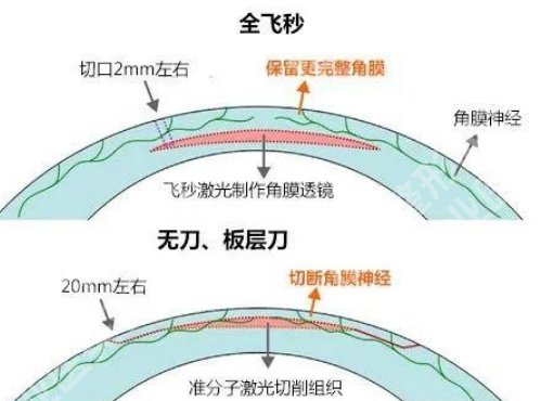 南京中大医院眼科哪个医生好？技术医生在线，主打项目介绍