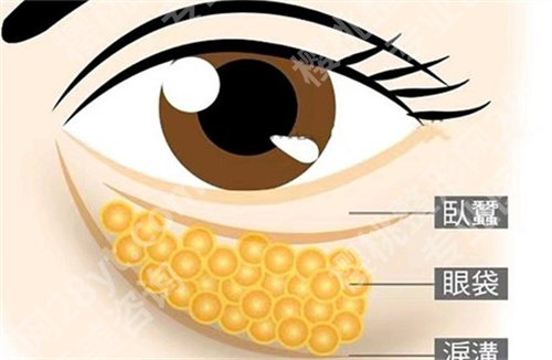 杭州第二人民医院祛眼袋多少钱？人气名单介绍
