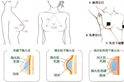 浙江荣军医院去疤痕怎么样？带来专家团队可以一览