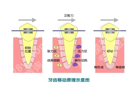 苏州大学附属第一医院牙齿矫正多少钱？附详情价格+案例解说