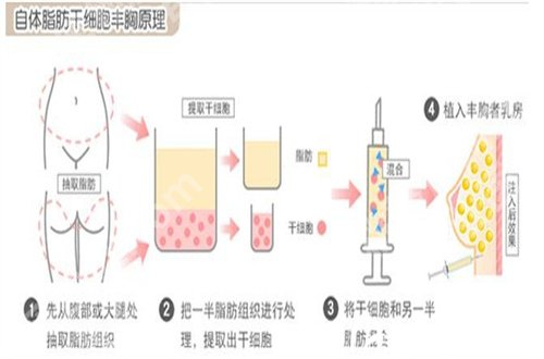 江苏省中医院做双眼皮需要多少钱？详细介绍医院详情