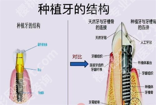 上海长海医院种植牙,价格贵吗？一文了解医院信息