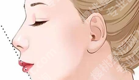 镇江第一医院抽脂怎么样？查看医院资料及2024价格表汇总