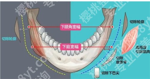 长海医院颌面外科怎么样？2024年价格表公布了！