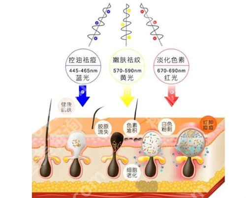 广州医科大学附属第二医院光子嫩肤多少钱？看科室简介内容