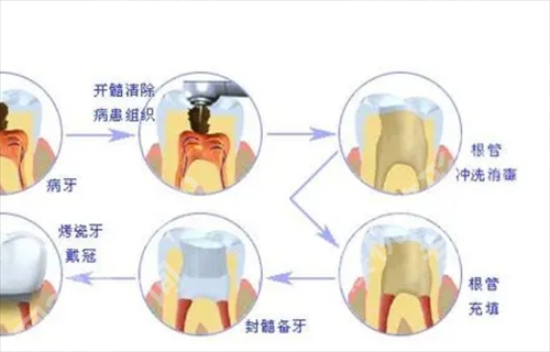 兰大二院种植牙怎么样？主打项目曝光，医院实力查看