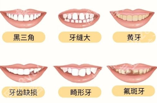 南方医科大学南方医院牙科价目表一览！医院详情介绍来了