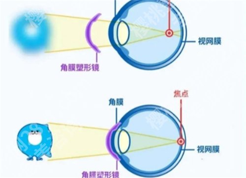 广州军区总医院近视激光怎么样？医院简介，项目推荐