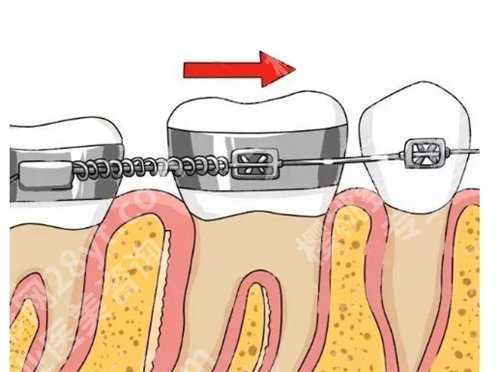中山三院牙齿矫正怎样？医院简介，一文了解