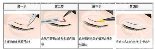 深圳眼科医院近视眼手术价格是多少？看医院项目推荐