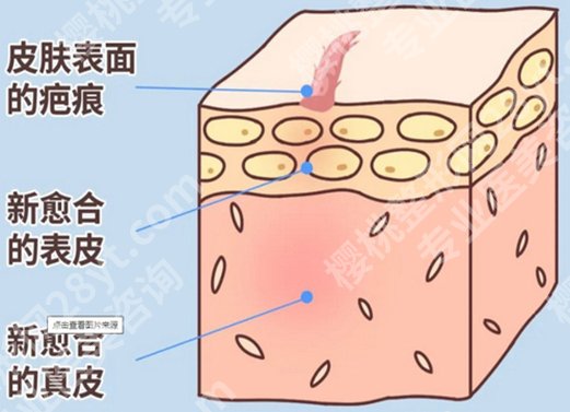 东莞人民医院整形科怎么样？公布医院介绍及院内案例曝光