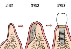 中山市小榄人民医院牙科怎么样？主打项目介绍，一键查看