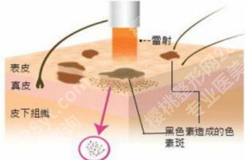 广东省第二人民医院点阵激光怎么样？医院信息介绍，价格表公布