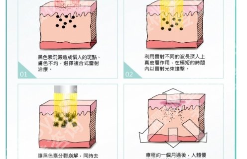 广州市第一人民医院激光祛斑怎么样？医院亮点介绍