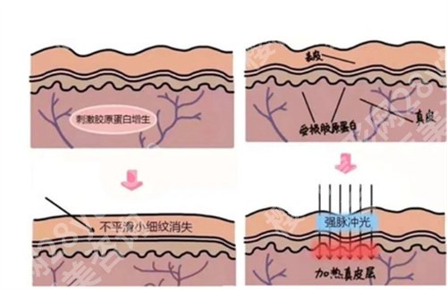 广东省第二人民医院激光整容科怎么样？看近期顾客点评