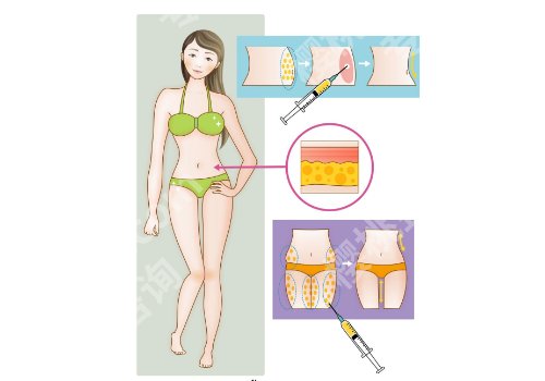 东莞美立方吸脂怎么样?医院介绍及真实点评分享 