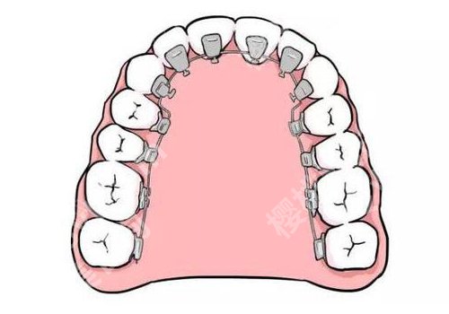 杭州格莱美做牙齿矫正怎么样？医院信息及真实点评曝光