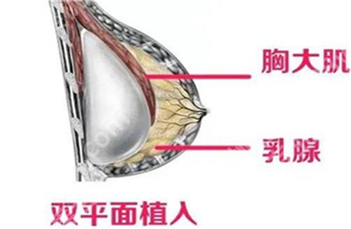 深圳美莱隆胸大概要多少钱？价格表在线看，医院