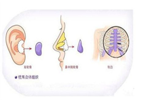 深圳富华整形医院隆鼻怎么样？医院信息介绍，好评一键查看