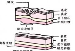 广州中科美整形医院激光祛斑价格贵吗？激光祛斑案例分析