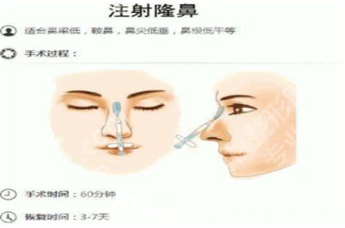 北京协和医院做双眼皮价格一览，基本信息已经揭晓了