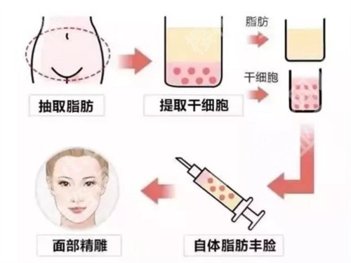 杭州第一人民医院脂肪填充价格是多少?收费明细在线预览