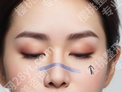 范荣杰医生案例怎么样？详细案例速来看看