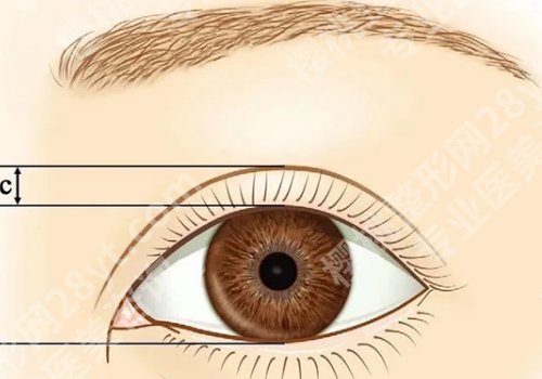 杭州艺星和台州艺星哪边双眼皮更好？医院实力分析和综合对比