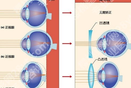 北大深圳医院近视激光费用贵吗？科室实力曝光