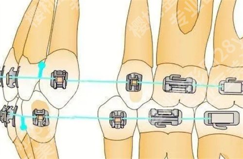 北京大学口腔牙齿矫正价格怎么样？科室简介，特色项目