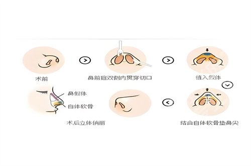 上海第十人民医院点阵激光多少钱？2024新资料介绍了
