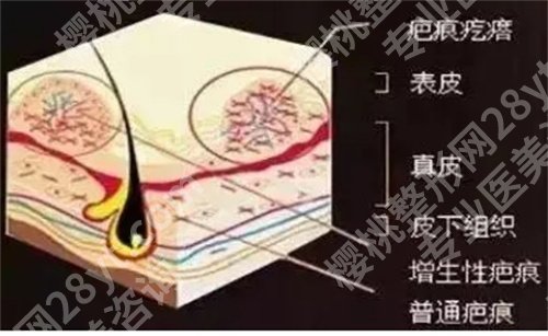 上海华山医院去疤痕挂什么科？特色项目介绍，速速查看