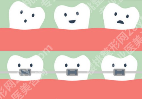 重庆维乐口腔矫正好不好?医院亮点、案例公布