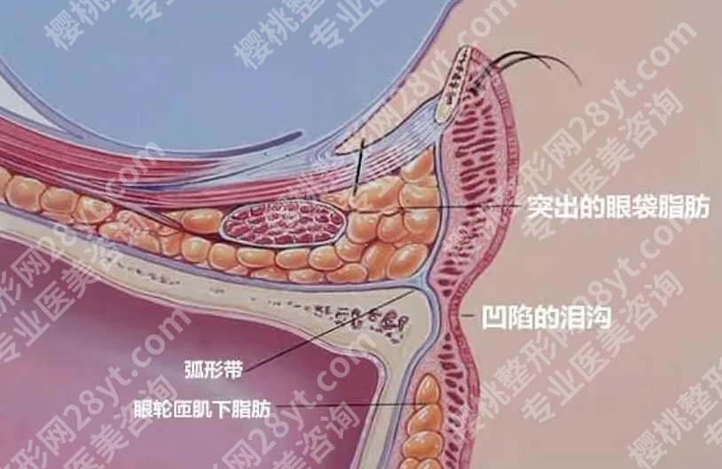 武凤莲医生擅长的项目有哪些？眼袋经典案例|见证TA的蜕变