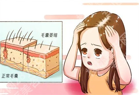 成都大麦微针植发是正规医院吗？热门项目介绍了优势