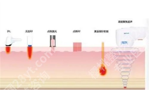 上海华美激光价格比九院贵真的吗?主打项目公布,细节曝光