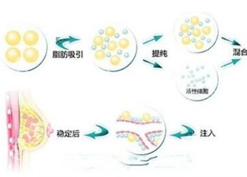 深圳美加美隆胸价格怎么样?医院详情介绍,口碑点评