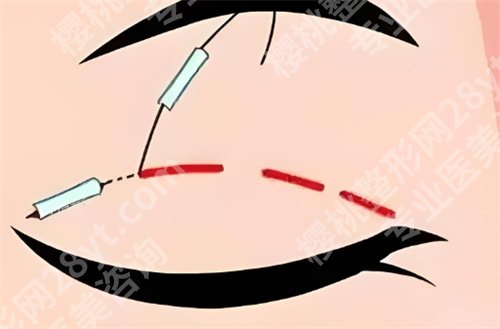 荔湾区人民医院做眼睛多少钱？医院亮点，详情介绍