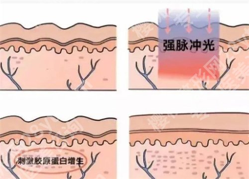 深圳艺星做热玛吉多少钱？2024年价格表在线查看