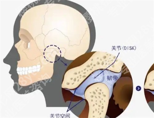 吴中兴教授正颌手术术后案例反馈！技术在线点评