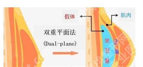 深圳阳光整形医院隆胸价格是多少？看项目定价标准