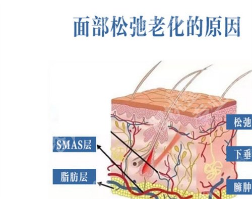 武汉美基元整形医院做拉皮怎么样？看医院主推项目